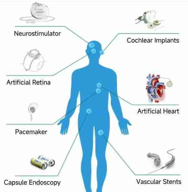Implantable Medical Devices