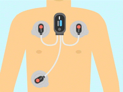 Wearable Medical Devices